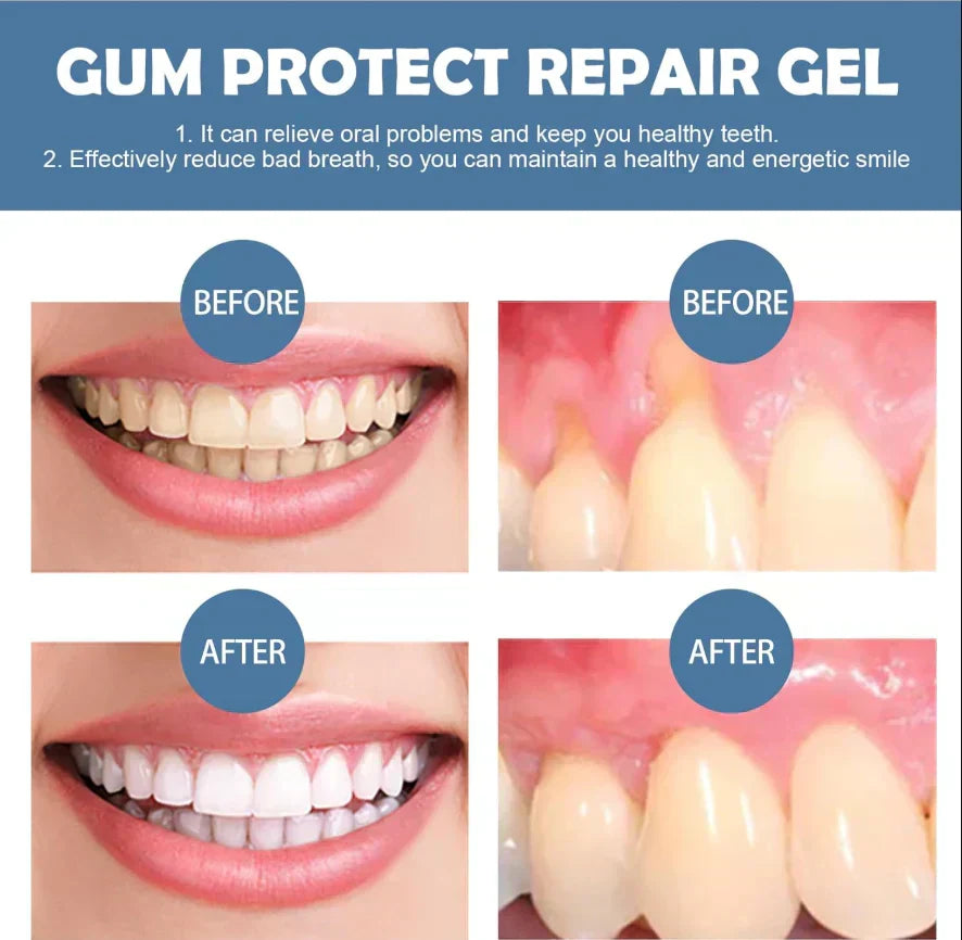 📢📢50% Off!!⏰ Teeth Whitening& Repair Gel 🦷
