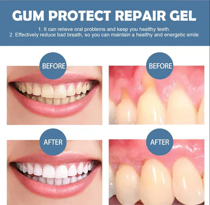 📢📢50% Off!!⏰ Teeth Whitening& Repair Gel 🦷