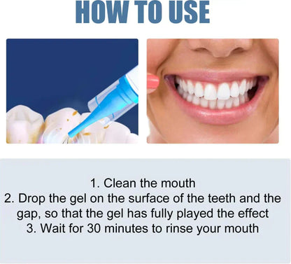 📢📢50% Off!!⏰ Teeth Whitening& Repair Gel 🦷
