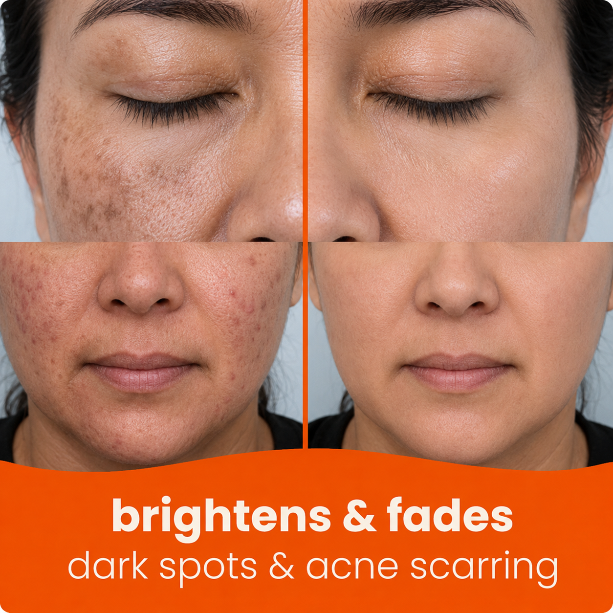 🔥Last Day 68% OFF-Vellorisa Turmeric Kojic Glow Pads