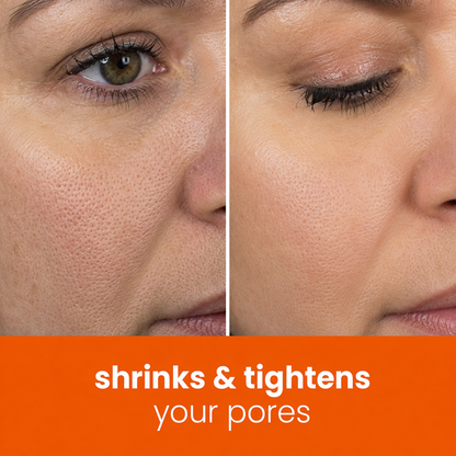 🔥Last Day 68% OFF-Vellorisa Turmeric Kojic Glow Pads